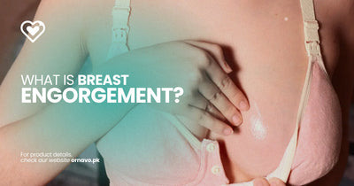 What is Engorgement — And How To Treat It